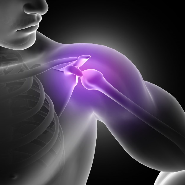 Shoulder Impingement Syndrome: Causes, Symptoms & Treatment Explained – Dr Sumit Badhwar