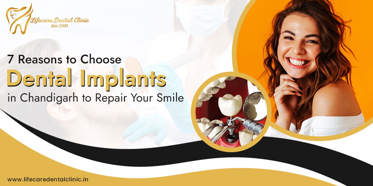 7 Reasons for Choosing Dental Implants in Chandigarh | Lifecare