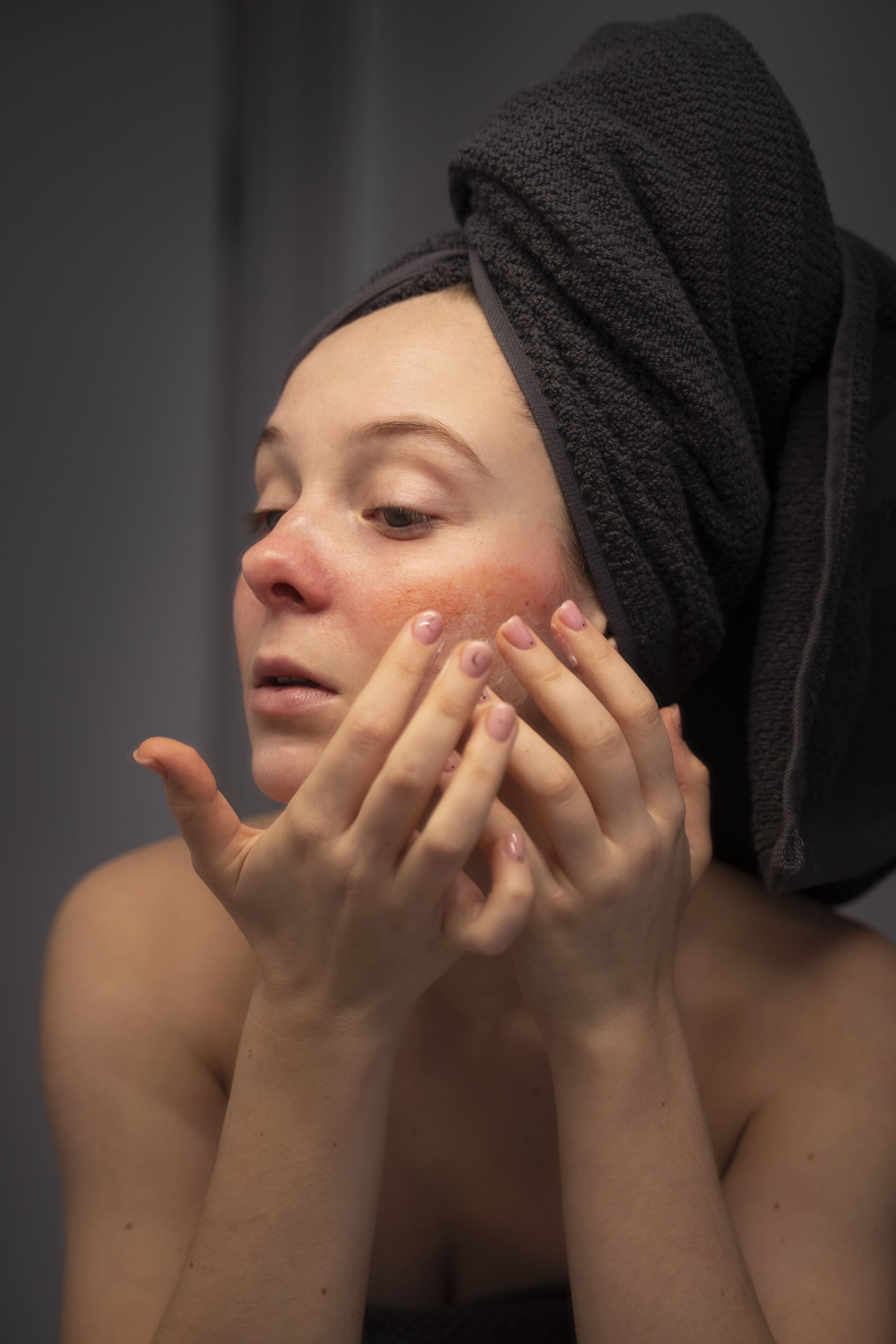 Identifying Signs and Symptoms of Acne Scars  | Lifehack