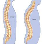 Best Spine Surgery Hospitals in India Profile Picture