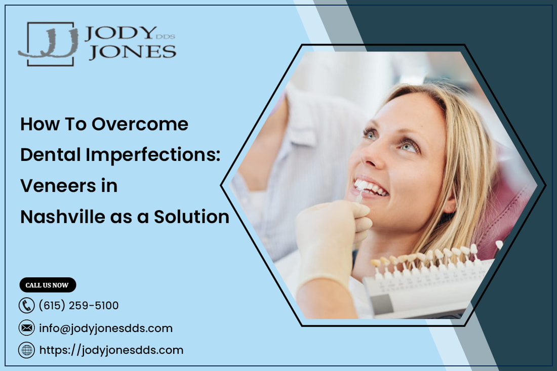 How to Overcome Dental Imperfections: Veneers in Nashville as a Solution - MY SITE