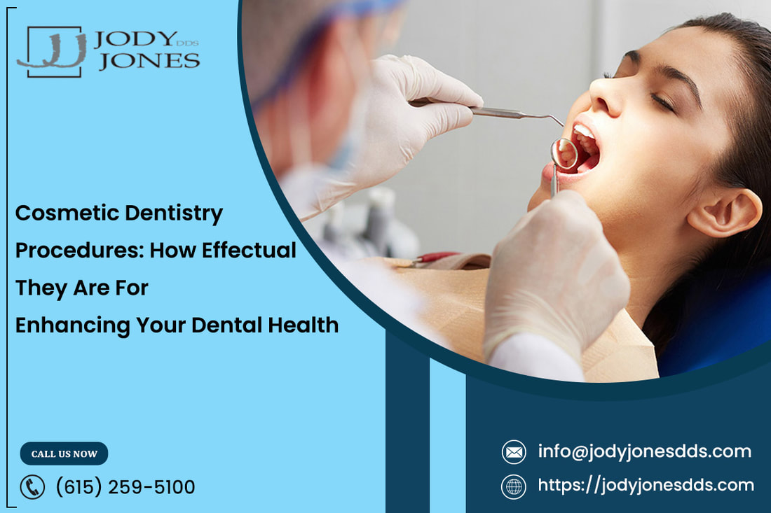 Cosmetic Dentistry Procedures: How Effectual They Are For Enhancing Your Dental Health - MY SITE