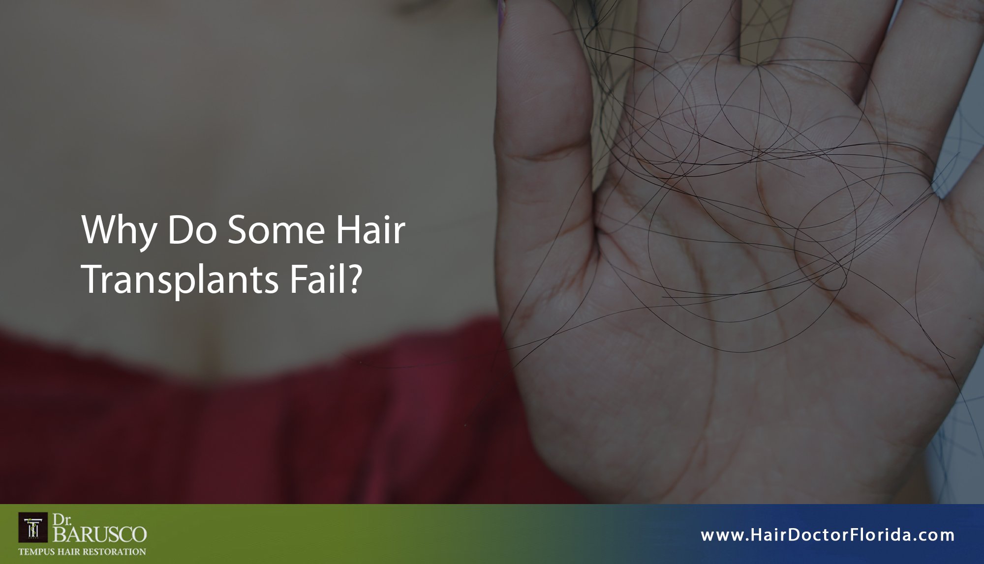 Why Do Some Hair Transplants Fail? - Tempus Hair