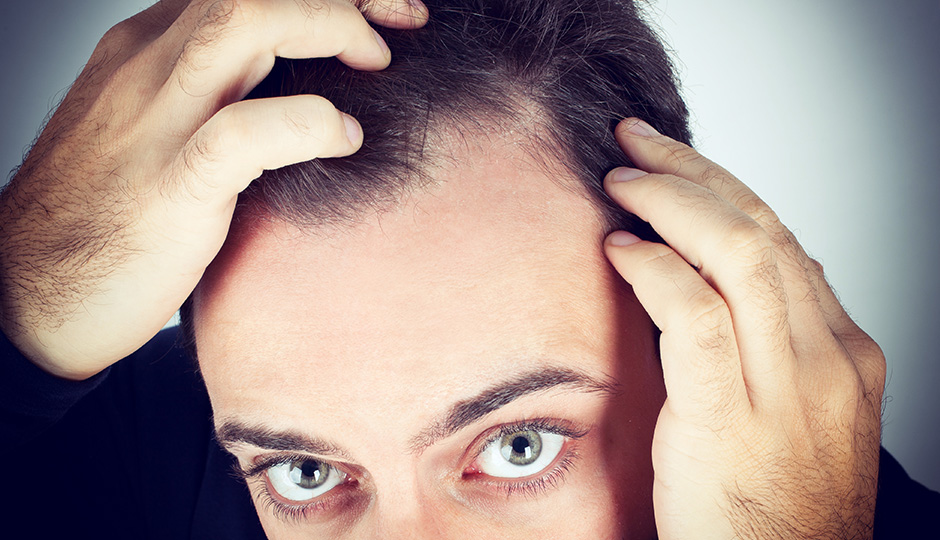 How To Maintain And Care For Your Normal Male Hairline - Blog Read News