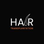 Hair Transplantation Profile Picture